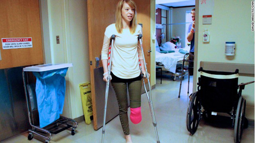 Los cirujanos amputaron su pierna desde 5 pies debajo de la rodilla izquierda. “Me volví loca. Eso es muy difícil de es- cuchar”, dijo.